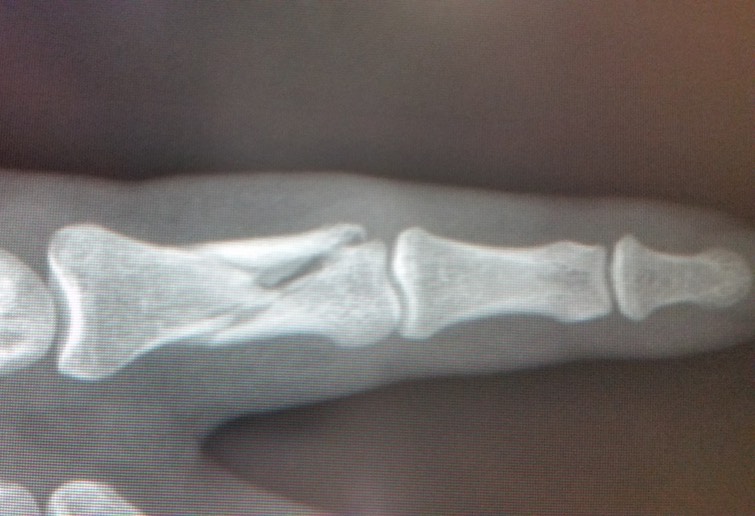 20141103_094713 - Version 2